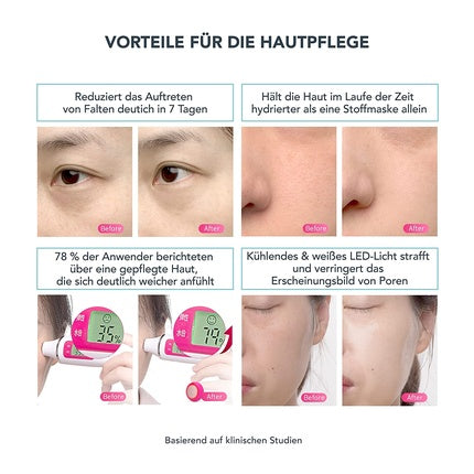 Dispozitiv facial, Foreo UFO 2, mint, T-Sonic