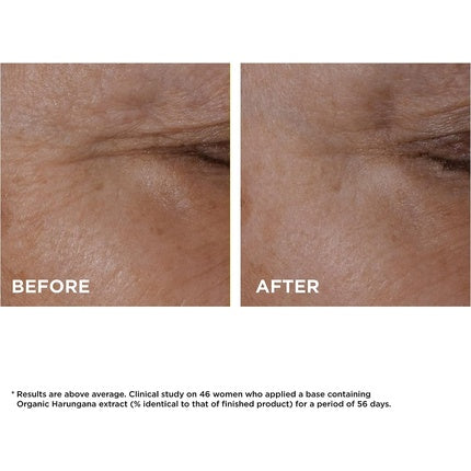 Concentrat antirid pentru ochi, Clarins, Total Eye Lift, 15ml