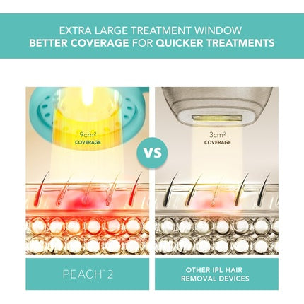 Aparat epilare IPL, Foreo, Peach 2, tehnologie răcire piele, mentă