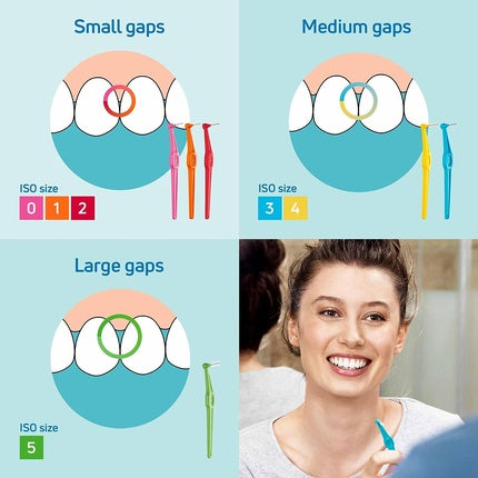 Periute interdentare, Tepe, Angle, set mixt