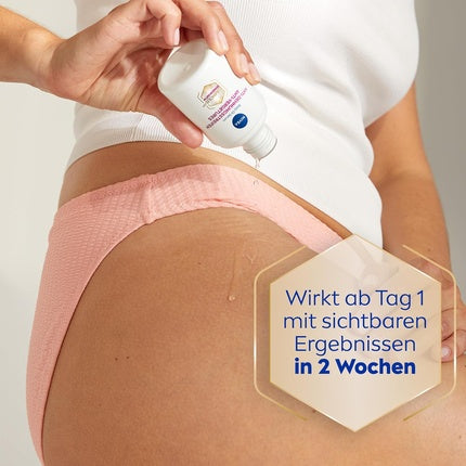 Ser corp Nivea Luminous630 anti-vergeturi, alb, 120g