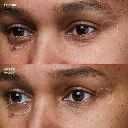 Crema de ochi, Shiseido Benefiance, 15ml, hidratare 48h