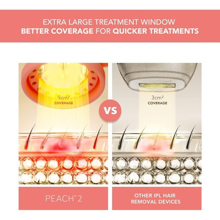 Aparat IPL, Foreo Peach 2, epilare permanentă