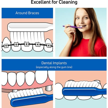 Periuță dinți Tepe Implant Orthodontic, 15cm, 20g