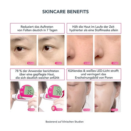 Aparat masaj facial, Foreo UFO 2, roz sidefat, 93g