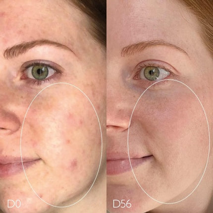 Gel de curatare purificator, Caudalie, Vinopure, 150ml