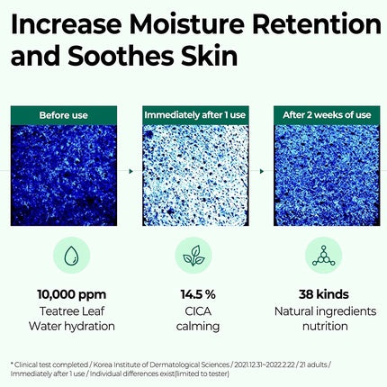 Serum antiacneic AHA BHA PHA Some By Mi Miracle, ingrijire faciala