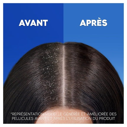 Șampon Head & Shoulders Classic 3x500ml Alb