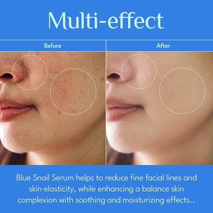 Serum față, It's Skin, Blue Snail, alb, 1.35 oz