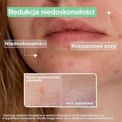 Ser anti-imperfecțiuni Mixa, acid salicilic, niacinamidă