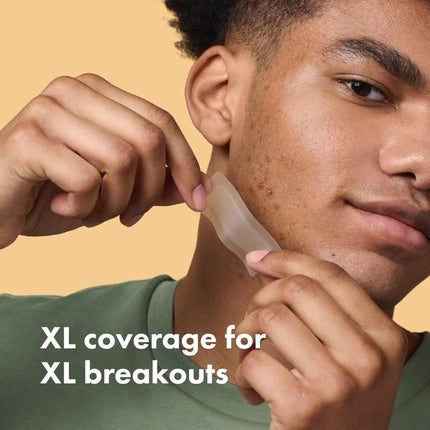Mighty Patch Surface Spot Patches, Hero Cosmetics, XL Spot Remover