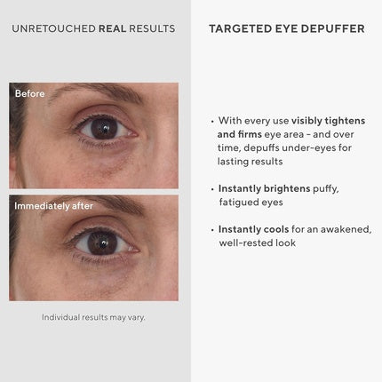 Cremă pentru ochi, Murad, Targeted Eye Depuffer, 15 ml