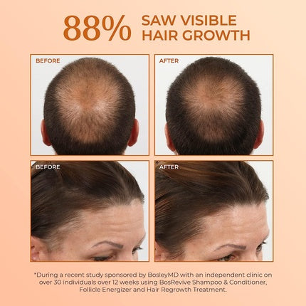 Condiționar Bosley MD, BOS-Revive Volumizing Conditioner pentru păr subțire, cu extracte de rozmarin și semințe de dovleac - 10.1 Ounce