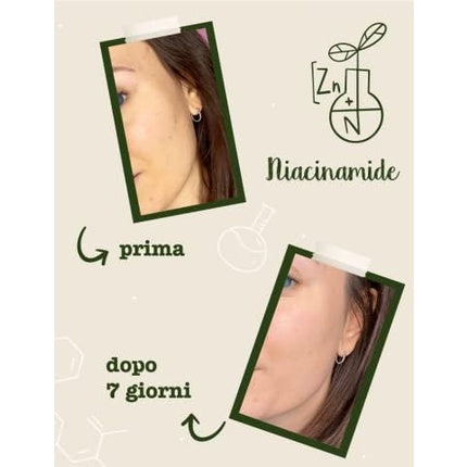 Ser Vitaminic, La Saponaria, Niacinamide Zinc, verde