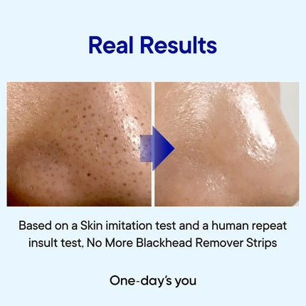 Ser Pore Clarifying, One-day's You, No More Blackhead Cleaner, 100 ml