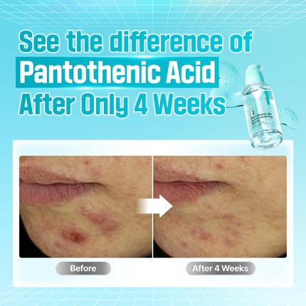 Serum Facial Numbuzin No.1 Pantothenic B5 Active Soothing, 30 ml