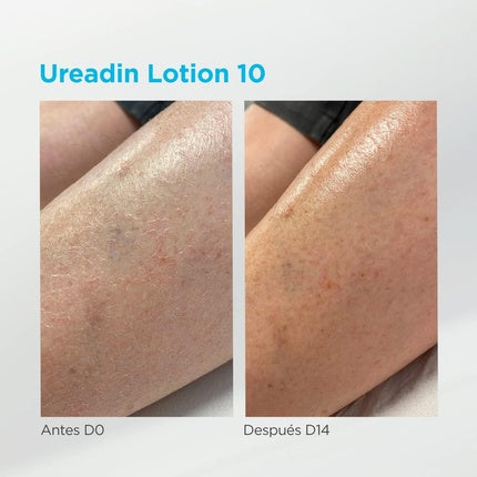 Lotiune hidratante, ISDIN Ureadin, 400g