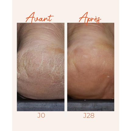 Cremă Protectoare Intensă pentru Picioare Uscați, Alvadiem, 100ml