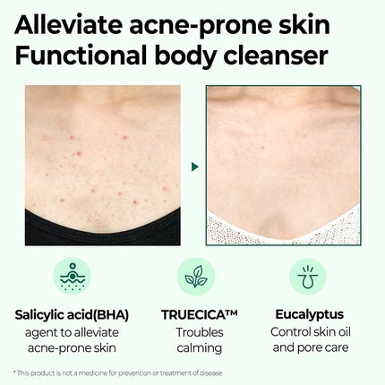 Gel de duș Some By Mi AHA BHA PHA 30 Days Miracle Acne Clear Body Cleanser 400 ml