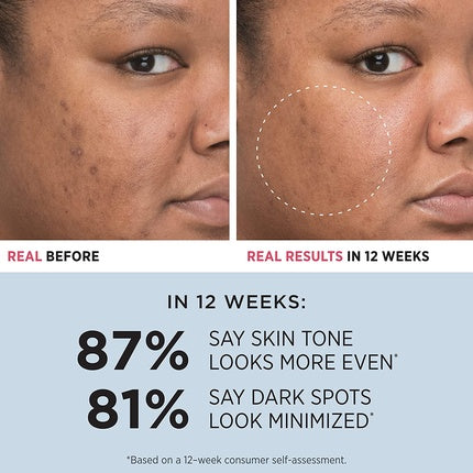 Serum It Cosmetics Bye Bye Dark Spots, 4% Niacinamide, 1% Vitamina C