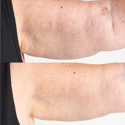 Loțiune corp, Perricone MD, Hyaluronic Intensive, maro