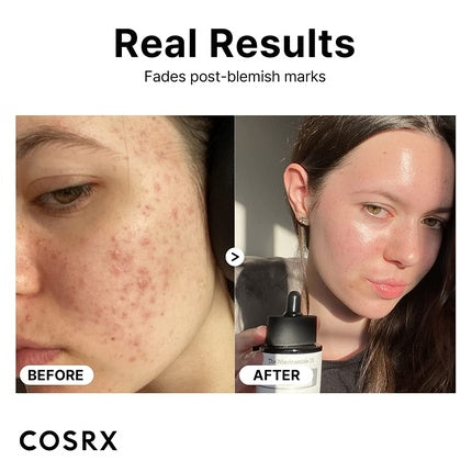 Ser Anti-Aging, COSRX, Niacinamide 15% cu Zinc 1%, 20ml, transparent