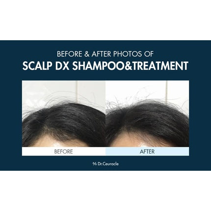 Șampon, Leegeehaam, Scalp DX, alb, cu pompă
