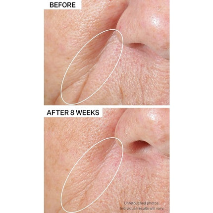 Serum pentru fata Strivectin Peptight, 1.7oz