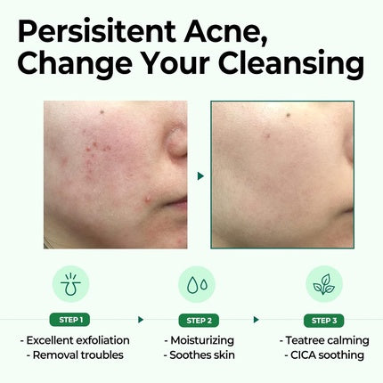Săpun facial, Some By Mi, 106g, exfoliant delicat