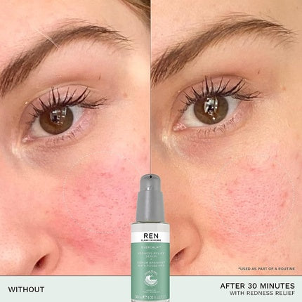 Serum hidratant REN Evercalm pentru reducerea roșeții, 30ml