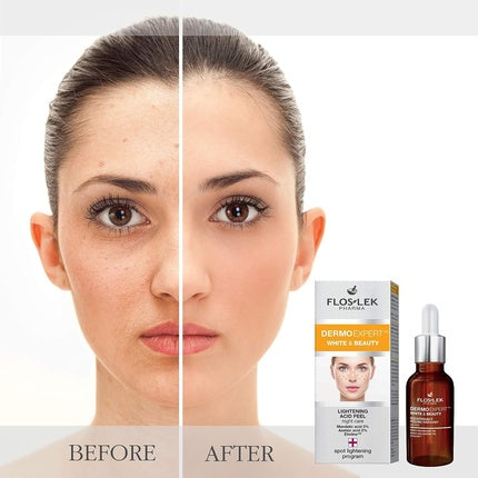 Peeling de Noapte, Floslek, 30ml, pentru toate tipurile de piele