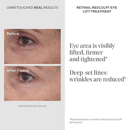 Cremă Ochi, Murad, Retinal ReSculpt, verde, 15ml