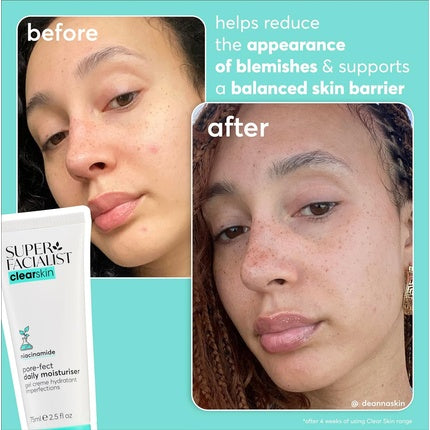 Serum, Super Facialist, Breakout Buster, albastru, 30ml