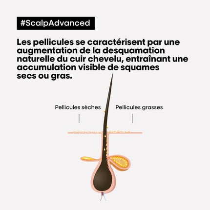Sampon antimatreață, L'Oréal Scalp Advanced, 300ml