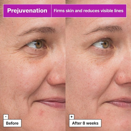 Serum Anti-îmbătrânire Dr. Jart+ Prejuvenation Firming Bakuchiol, 30 ml