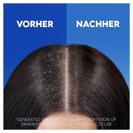 Șampon Head & Shoulders, Anti-Mătreață, 300ml