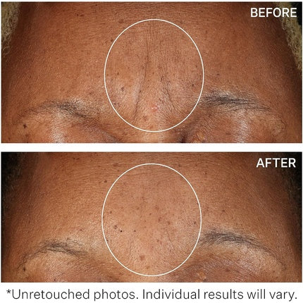 Concentrat hidratant, Strivectin, SD Advanced Plus, 60ml