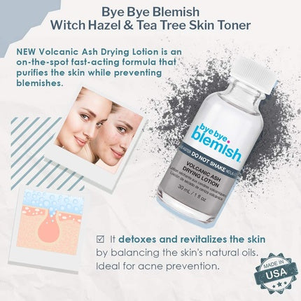 Bye Bye Blemish Volcanic Ash Drying Lotion, 30 ml