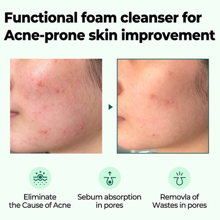 Spumă de curățare facială, Some By Mi, 100 ml, acnee