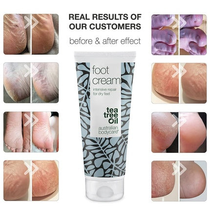 Crema pentru picioare Australian Bodycare cu ulei de arbore de ceai, 130g