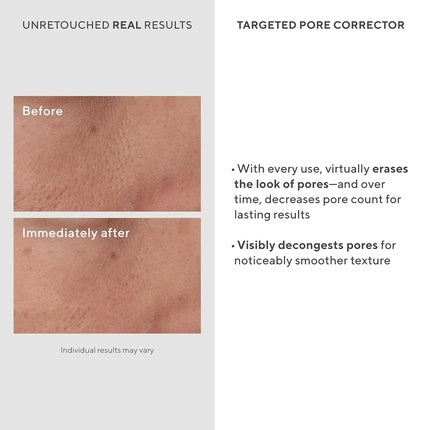 Tratament corector pori, Murad, Targeted Pore Corrector, 17g