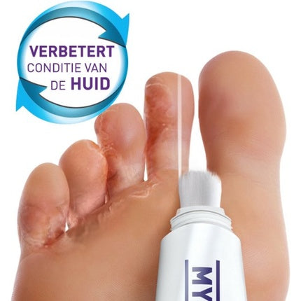 Mycosan Foot Fungus Treatment