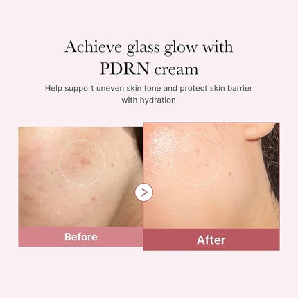 Crema facială Medicube Salmon DNA PDRN Pink Hyaluronic Moisturizing Cream, roz, 49 g