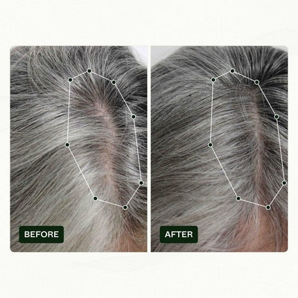 Ser pentru Păr, Scandinavian Biolabs, Bio-Pilixin, 100ml