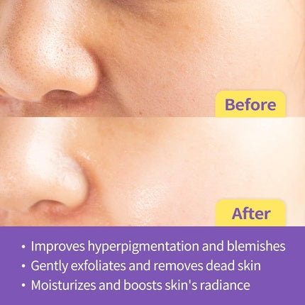 Serum Dermalogy By Neogenlab, Double Vita, galben