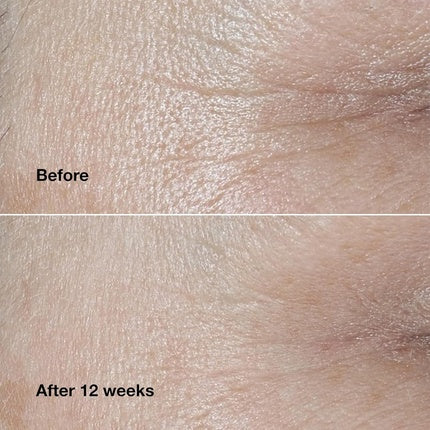 Crema de față Clinique Smart Clinical Repair Wrinkle Correcting, 49g, violet