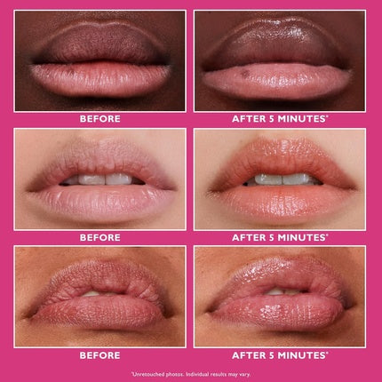 Tratament buze Peter Thomas Roth Instant FIRMx Lip Filler 10ml